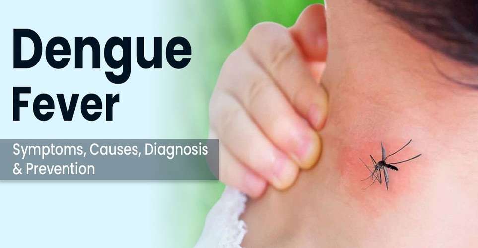 How To Prevent From Dengue Fever? Know Symptoms, Diagnosis & Treatment